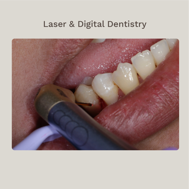 Laser and Digital dentistry