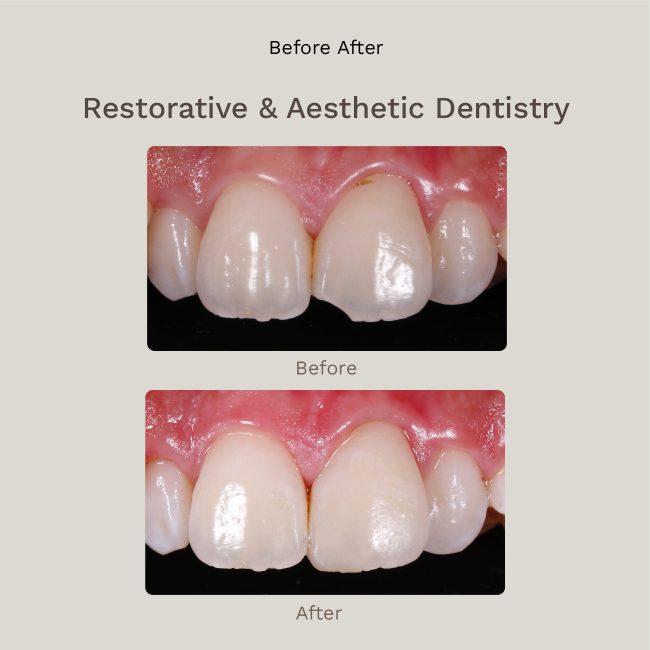 Restorative and Aesthetics Dentistry